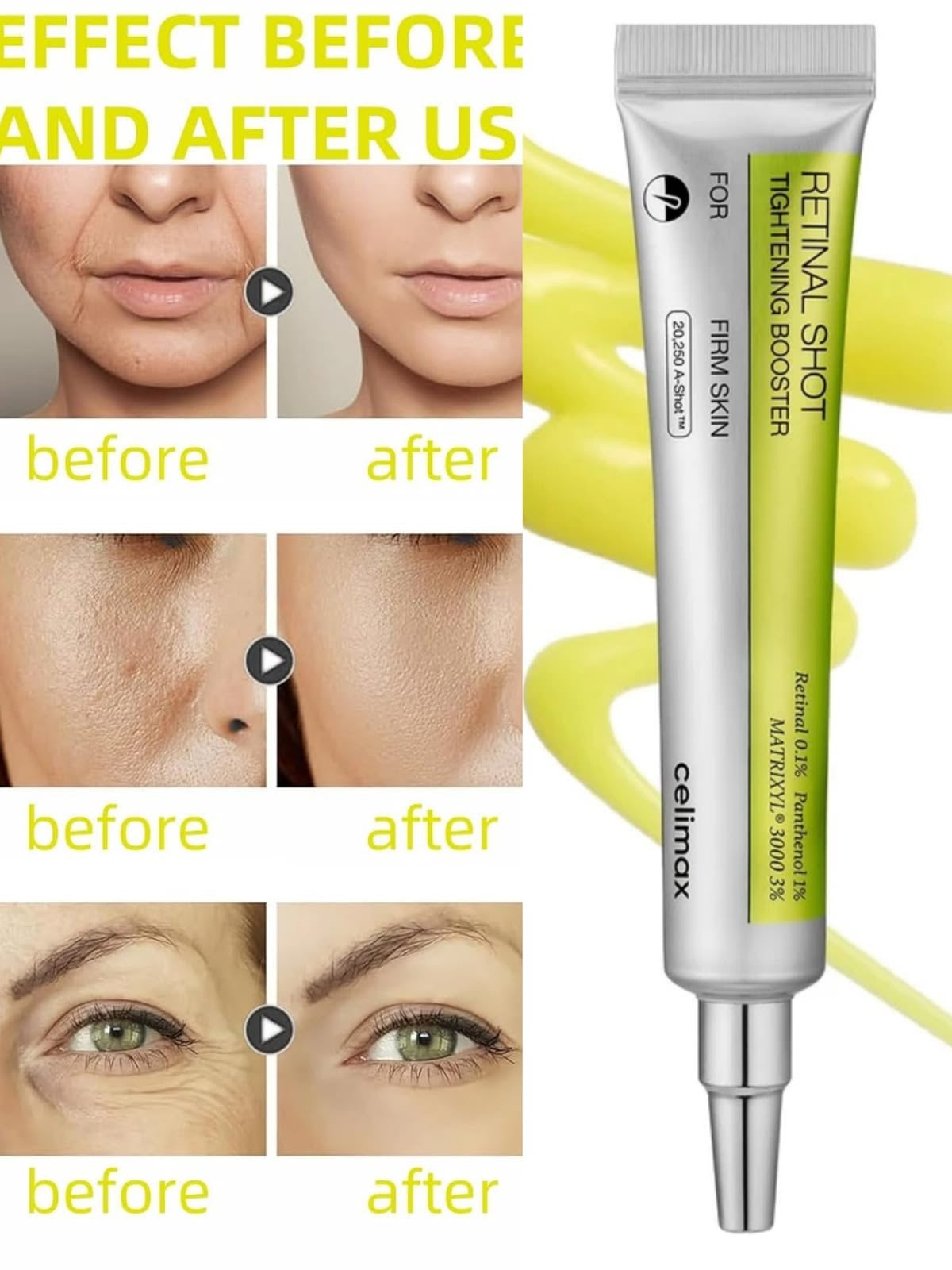 celimax - The Vita-A Retinal Shot Tightening Booster