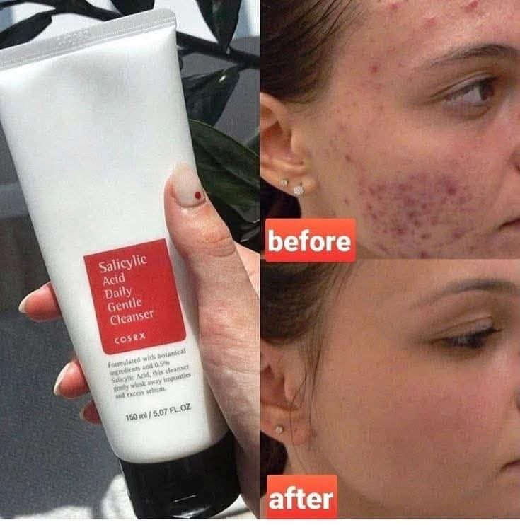 COSRX Salicylic Acid Daily Gentle Cleanser 150ml